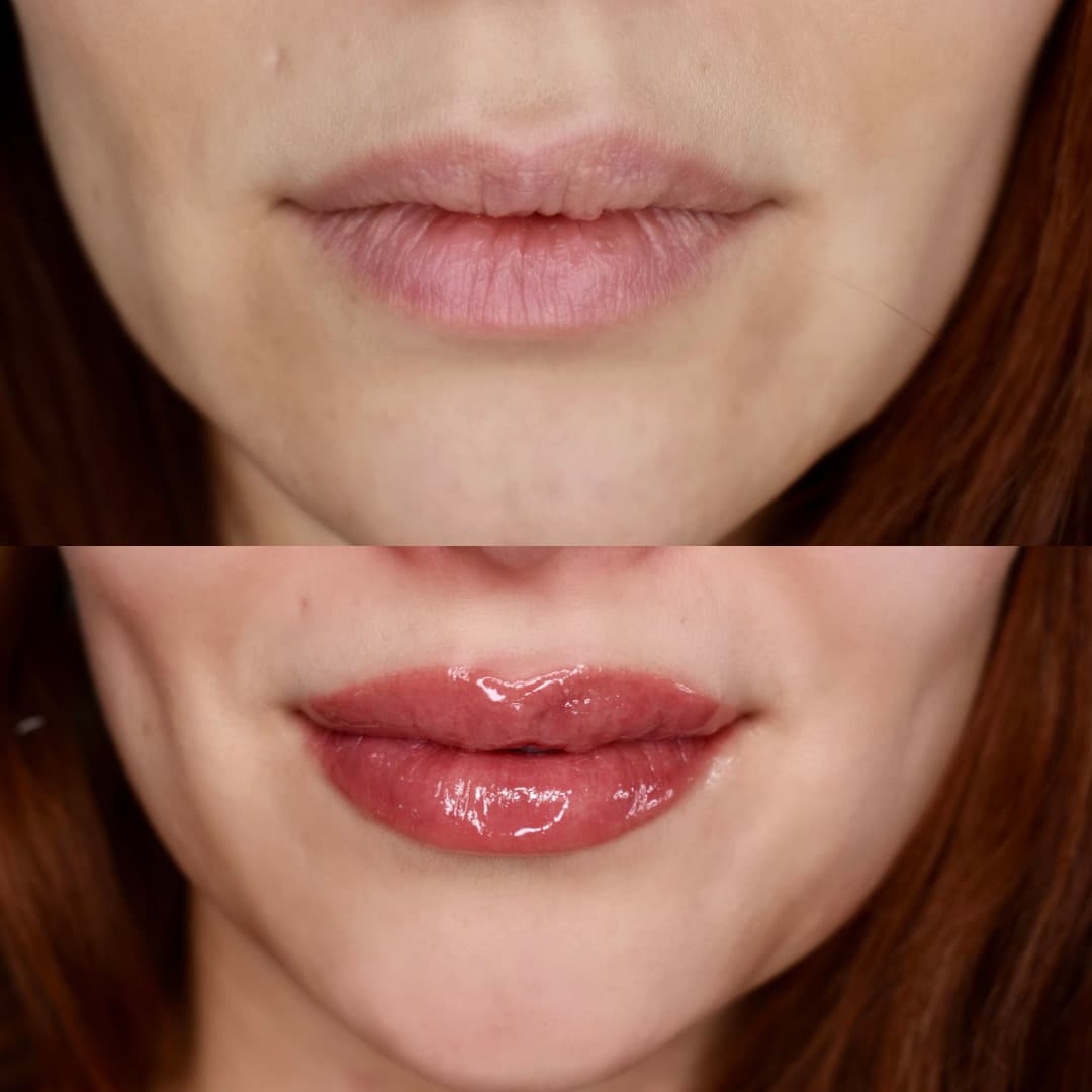 Lip Blush before and after transformation showing Beautiful natural tint that enhances natural beauty