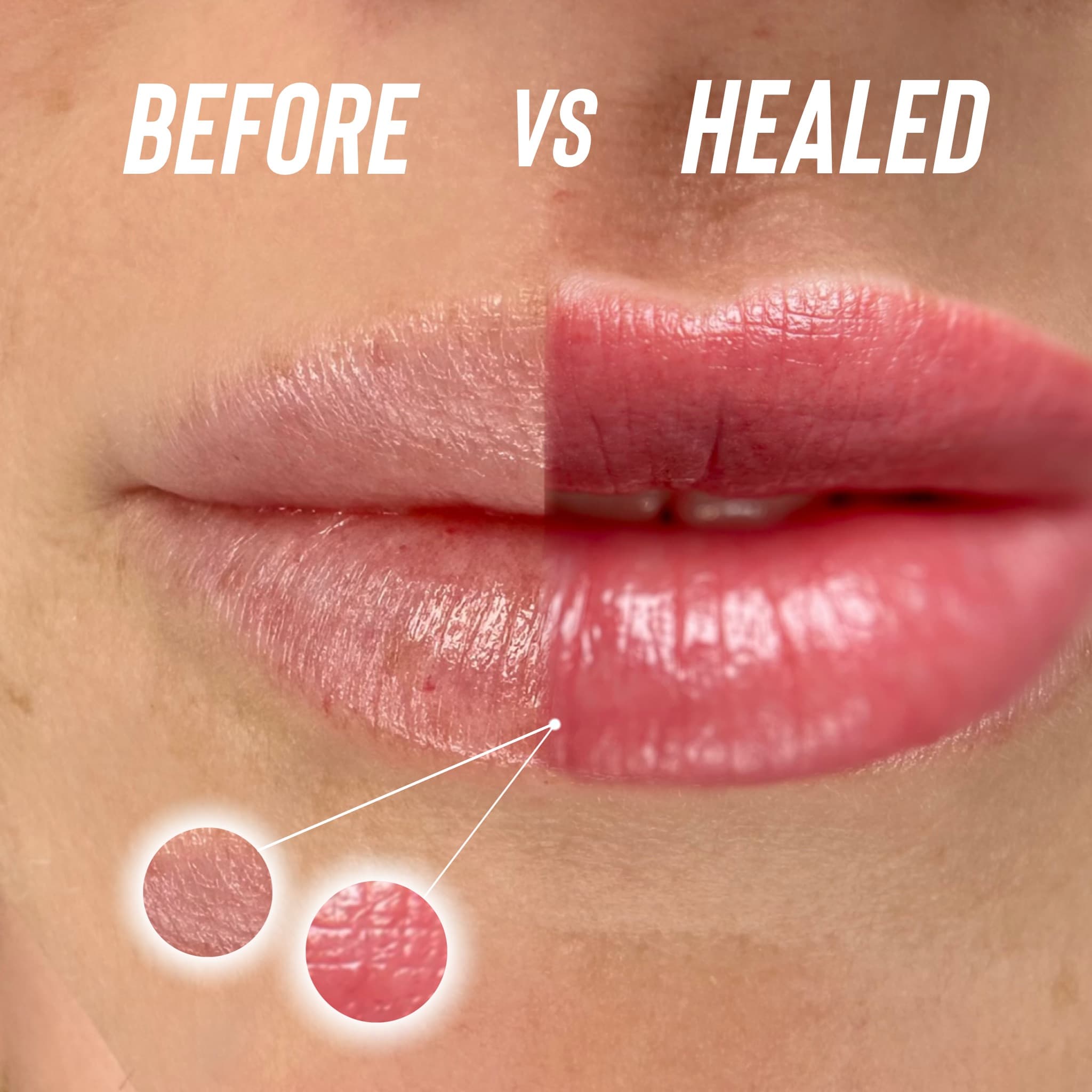Lip Blush before and after transformation showing Enhanced natural lip color with improved symmetry